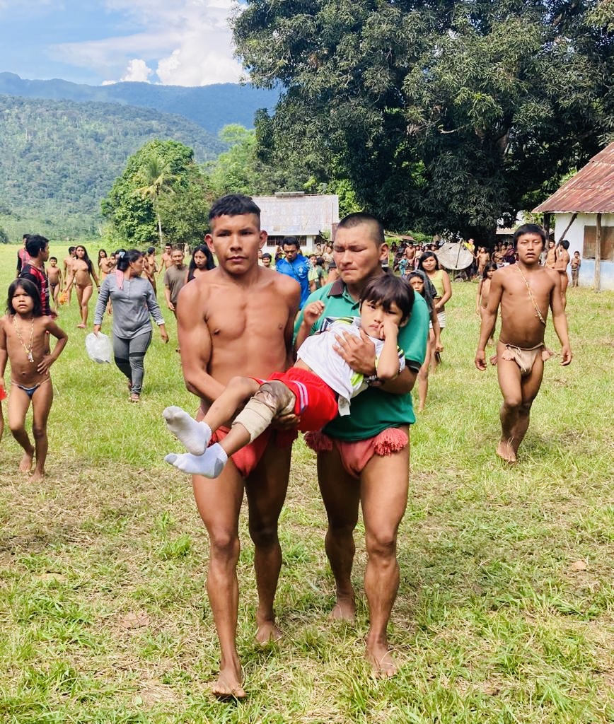 Dos hombres yanomami cargan a un niño herido a través de la comunidad mientras la asamblea acompaña, evidenciando la solidaridad ante la emergencia sanitaria